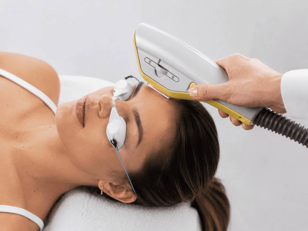 IPL Facial - Luz Intensa Pulsada